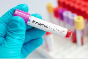 Norovirus Diagnosis